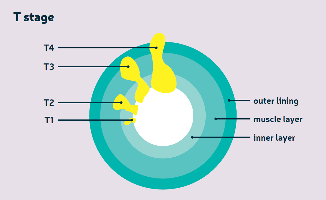 Staging and Grading Image - Copy - Copy - Copy.png