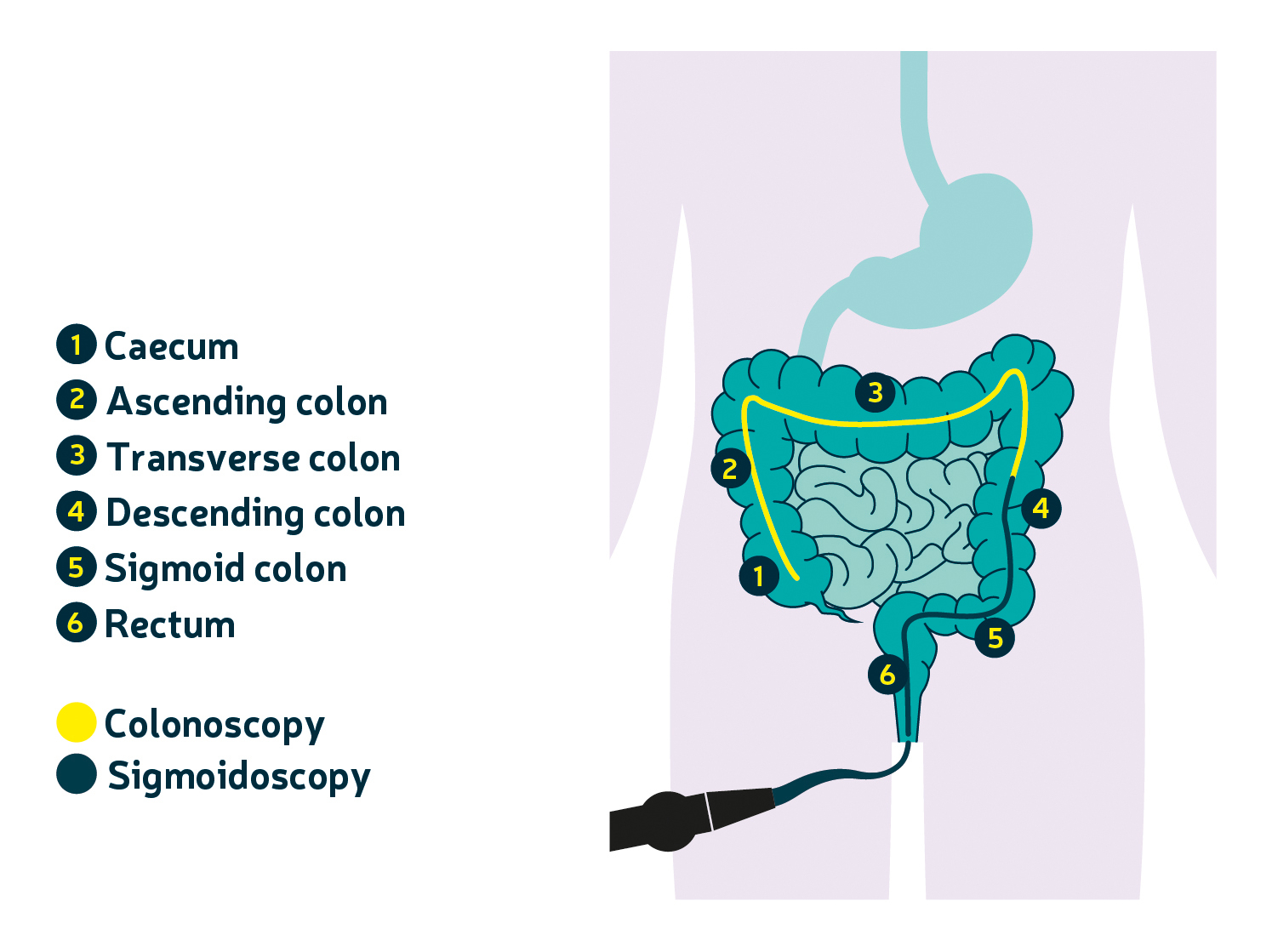 Colorectal Navigator Page - Under Endoscopy.jpg