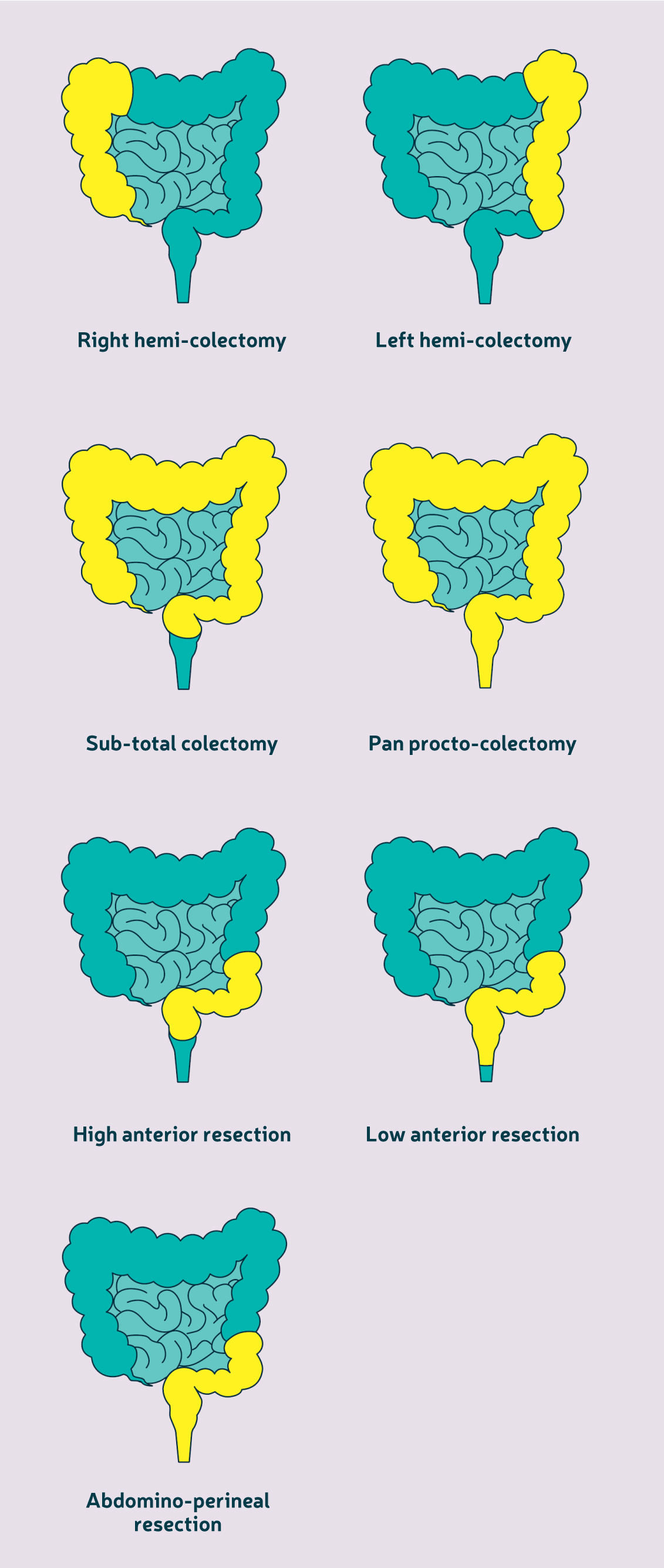 Under ERAS surgical school - tyoes of surgery.jpg